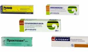 Как выбрать мазь от зуда, жжения и болей в заднем проходе