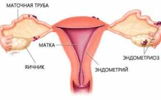 Группы препаратов для лечения эндометриоза