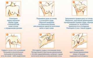 Мастопатия: причины симптомы и лечение