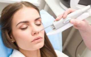 Базалиома на носу: основные симптомы и способы лечения опухоли
