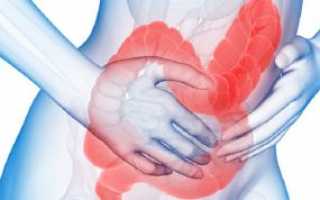 Причины, симптомы и лечение синдрома раздраженного кишечника